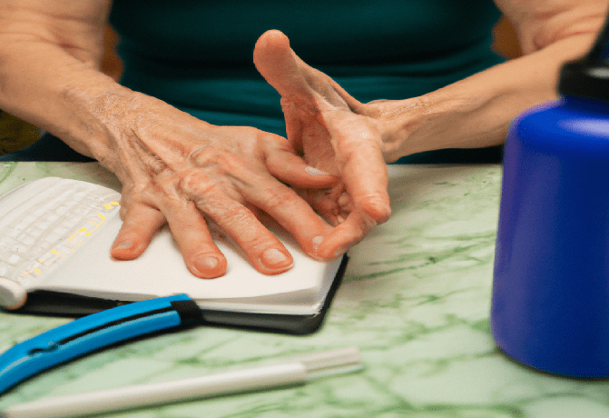 Behandlung rheumatoider Arthritis: Medikamente und Therapieoptionen